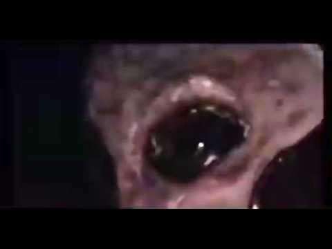 KGB interview of an NHI taken in the early 1990s