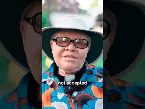 She Risks Her Life to Protect Albino Kids in Tanzania
